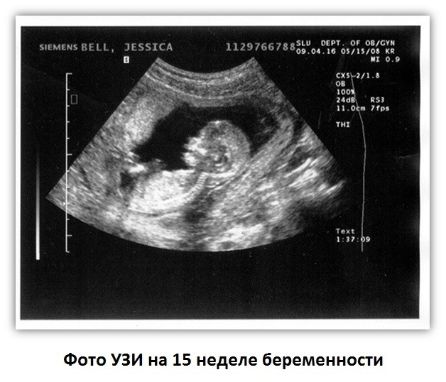 картинка Leksi_l