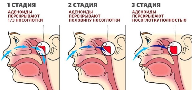 картинка encaramelle