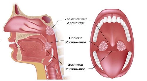 картинка encaramelle